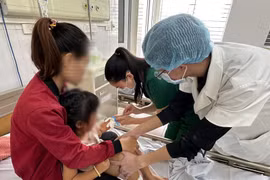 Bé gái 4 tuổi bị chó Pitbull lên cơn dại cắn nát mặt ở Hà Nội