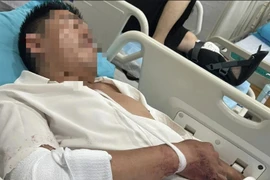 Thẩm phán ở Lâm Đồng bị tên trộm chém trọng thương