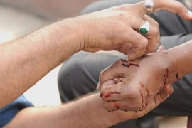 Trẻ 10 tuổi tử vong do người nhà chữa bệnh bằng dao lam