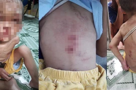 Nhìn thấy thương hình ảnh bé trai hơn 1 tuổi bị bạo hành dã man 