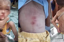 Nhìn thấy thương hình ảnh bé trai hơn 1 tuổi bị bạo hành dã man 