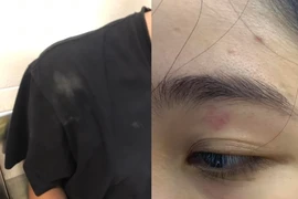 Quán bánh mì nổi tiếng Nguyên Sinh bị tố đánh khách, nói khách ngu dốt