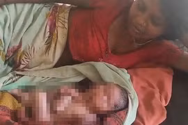 Em bé sinh ra có 2 khuôn mặt và 8 tay chân gây chấn động