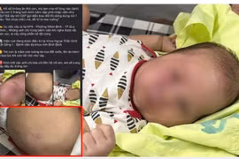 Nghi vấn cha ruột đánh con mới sinh 3 tháng tuổi nhập viện