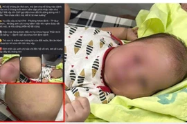 Nghi vấn cha ruột đánh con mới sinh 3 tháng tuổi nhập viện
