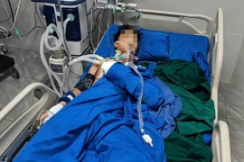 Tự chế tạo pháo, học sinh lớp 10 bị pháo nổ nát bàn tay