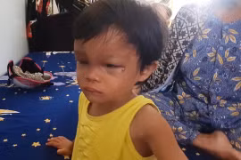 Bé gái 4 tuổi bị cha nuôi đánh đập tàn bạo ở miền Tây 