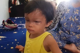 Bé gái 4 tuổi bị cha nuôi đánh đập tàn bạo ở miền Tây 