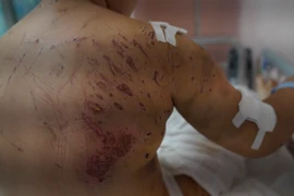 Bé gái 7 tuổi bị 4 con chó lao vào tấn công kinh hoàng 