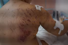 Bé gái 7 tuổi bị 4 con chó lao vào tấn công kinh hoàng 