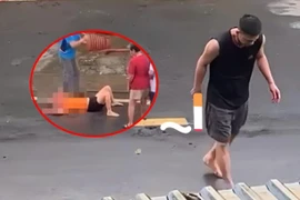 Nữ giáo viên bị chồng cầm dao chém liên tiếp vào người 