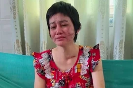 Công an đang xác minh thai phụ ở Kiên Giang tố chồng bạo hành