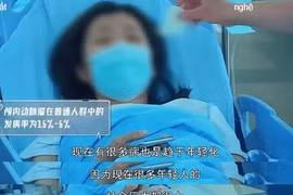 Cô gái 24 tuổi đột quỵ, nguyên nhân nhiều bạn trẻ biết vẫn làm