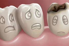 3 loại kem đánh răng không nên mua, tiềm ẩn mối nguy sức khỏe