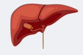 Vitamin có thể hại gan khủng khiếp, 4 loại phải cẩn trọng khi dùng