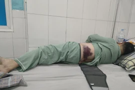 Đỗ xe trên vỉa hè, người đàn ông bị đánh nhập viện