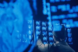 Mỹ sẽ tiên phong hồi sinh người chết?