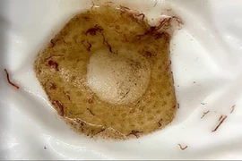 Đường nước sinh hoạt KĐT Pháp Vân - Tứ Hiệp đầy giun sán: Các bên liên quan nói gì?