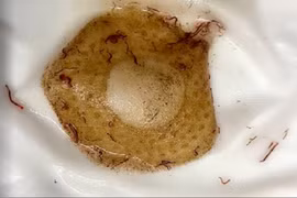 Đường nước sinh hoạt KĐT Pháp Vân - Tứ Hiệp đầy giun sán: Các bên liên quan nói gì?