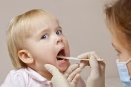 Bí quyết phòng chống bạch hầu sau bệnh nhi tử vong ở Đắk Nông