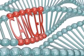 Thuốc chữa Parkinson giảm nguy cơ ung thư vú