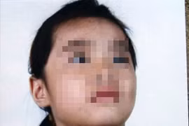 Tại sao chưa khởi tố kẻ hành hạ dã man bé 6 tuổi?