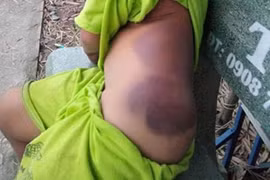 Đình chỉ công tác cô giáo bạo hành học sinh tại Long An