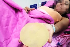 Ca sĩ Ivy Trần vỡ túi nâng ngực: Bác sĩ mổ nói gì? 