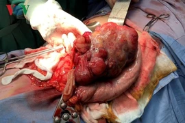 Phẫu thuật thành công cho bệnh nhân có khối u dạ dày nặng gần 2kg