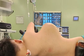 Phẫu thuật thành công cho cậu bé mang khối u “khủng” hiếm gặp