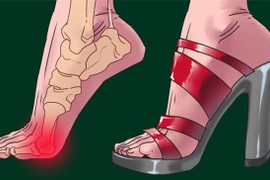 Đi giày cao gót quá nhiều, nguy hiểm đến 4 bộ phận trên cơ thể