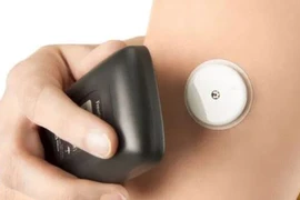 Trí tuệ nhân tạo AI chẩn đoán bệnh tiểu đường qua giọng nói trong 10 giây?