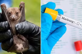 TP.HCM ra 2 văn bản khẩn vì lo ngại dịch bệnh kép