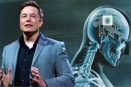 Công ty của tỷ phú Elon Musk chuẩn bị thử nghiệm gắn chip vào não người