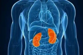 5 dấu hiệu ung thư thận không nên chủ quan
