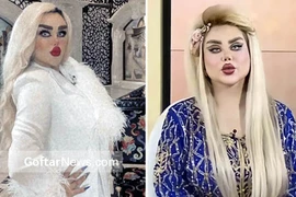 “Nghiện” phẫu thuật thẩm mỹ, cô gái biến dạng khiến dân tình hoảng