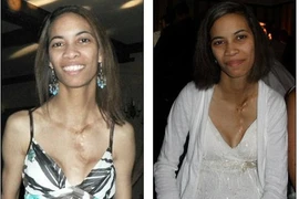 Bà mẹ có 2 tử cung vẫn sinh 2 con khỏe mạnh