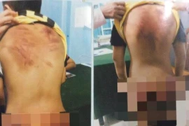 Thầy tu bị tố bạo hành trẻ em: Bé trai 11 tuổi ám ảnh mỗi khi đi ngang chùa