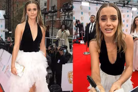 Emma Watson khiến nhiều người 'ngã ngửa' vì nhan sắc thật 