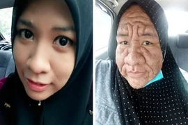 Người phụ nữ 28 tuổi bỗng chốc lão hóa như bà cụ 80