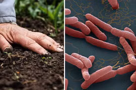 Ai có nguy cơ mắc bệnh Whitmore cao hơn?