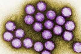 6 trẻ tử vong do virus Adeno: Biến chứng nguy hiểm sao?