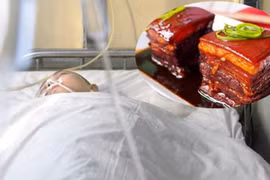 Người đàn ông 45t bị đột quỵ vì thói quen chế biến thịt lợn