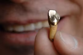 Cả gan trộm răng vàng từ thi thể người quá cố 