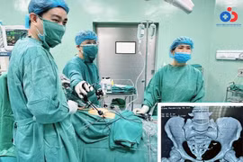 Thủng tử cung, đại tràng…vì vòng tránh thai