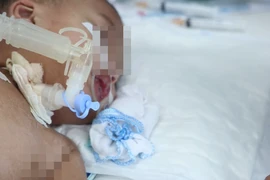 Bé 2 tuổi gặp biến chứng rất nặng sau nhiễm Adenovirus