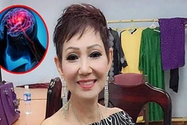 6 biểu hiện cảnh báo đột quỵ sớm ở nữ giới không được bỏ qua