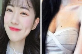 Má lúm đồng tiền, nốt ruồi trước ngực nhất định phải giữ gìn