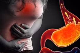 Căn bệnh "ngọc nữ" Tăng Thanh Hà mắc có nguy hiểm không?