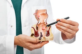 Bệnh trĩ gây biến chứng nguy hiểm thế nào?